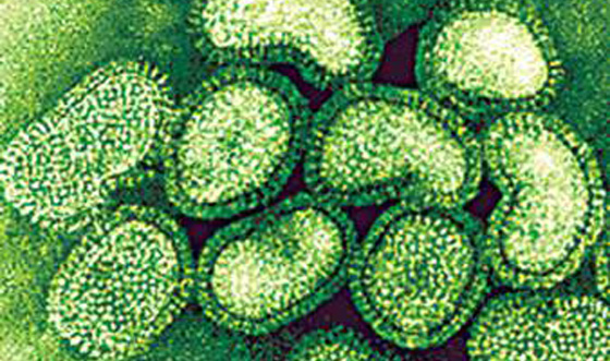 Swine Flu under a microscope.